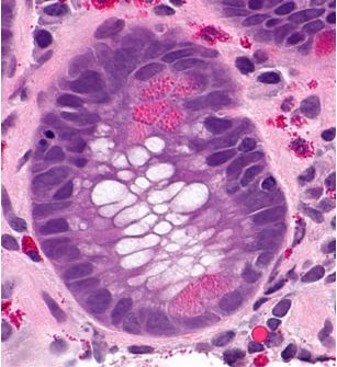 Paneth cell