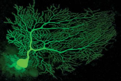Purkinje cells