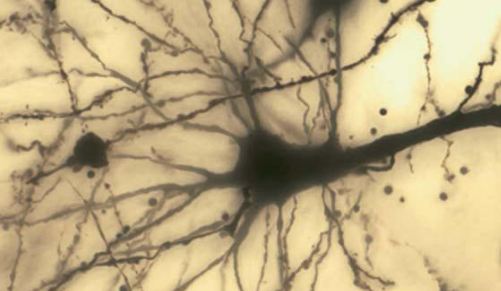 Spindle neuron