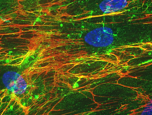 Внеклеточный матрикс (extracellular matrix)